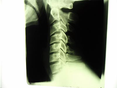 xray.jpg